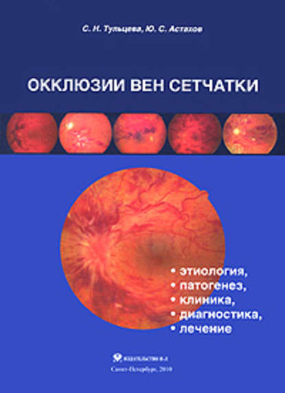 Окклюзии вен сетчатки (этиология, патогенез, клиника, диагностика, лечение) — Ю. С. Астахов