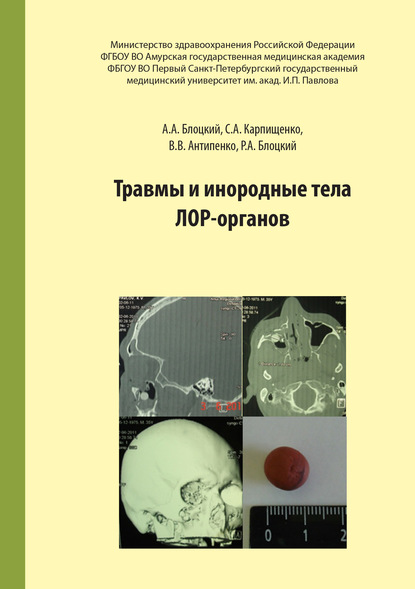 Травмы и инородные тела лор-органов — С. А. Карпищенко