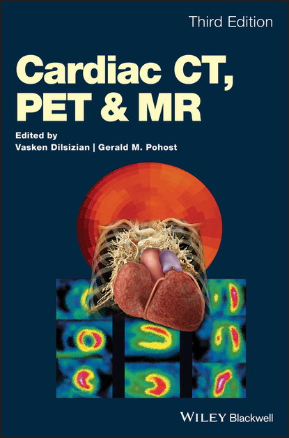 Cardiac CT, PET and MR — Группа авторов