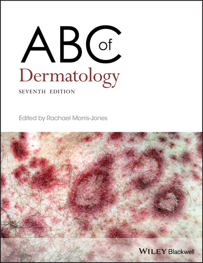ABC of Dermatology — Группа авторов