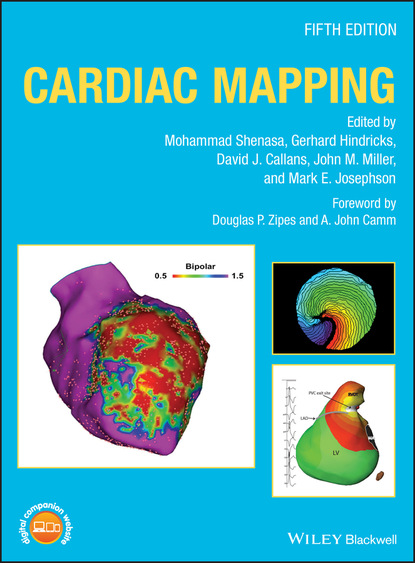 Cardiac Mapping — Группа авторов