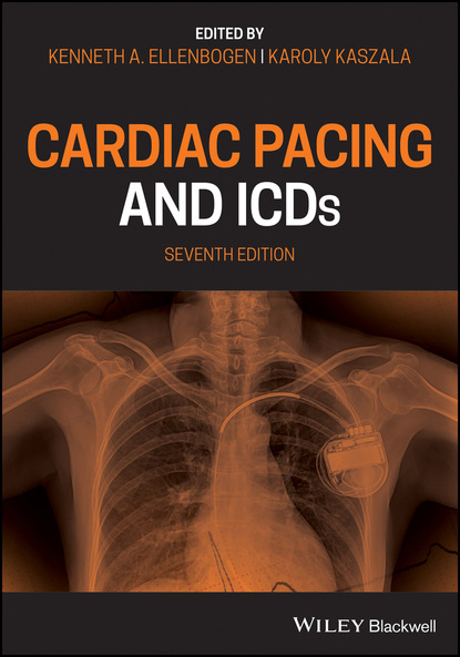 Cardiac Pacing and ICDs — Группа авторов