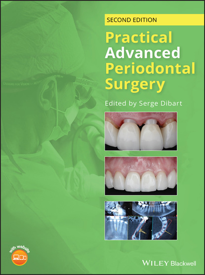 Practical Advanced Periodontal Surgery — Группа авторов