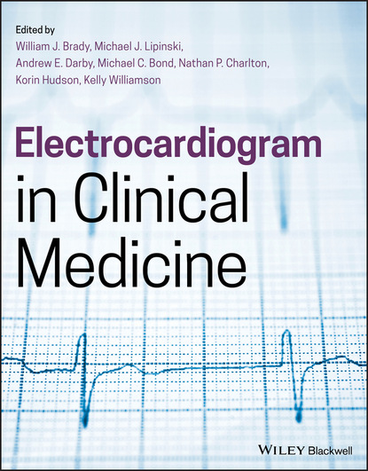 Electrocardiogram in Clinical Medicine — Группа авторов