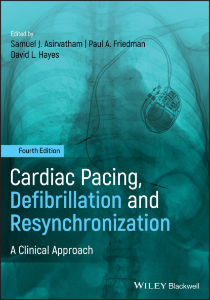 Cardiac Pacing, Defibrillation and Resynchronization — Группа авторов
