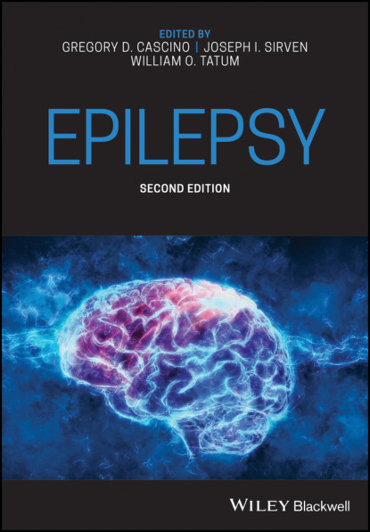 Epilepsy — Группа авторов