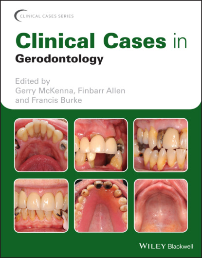 Clinical Cases in Gerodontology — Группа авторов