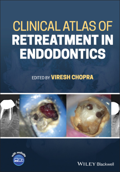 Clinical Atlas of Retreatment in Endodontics — Группа авторов
