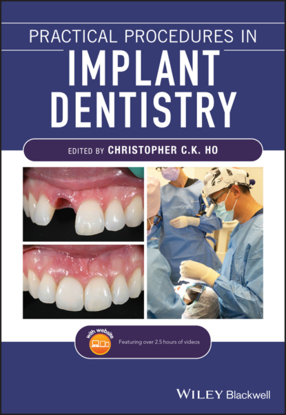 Practical Procedures in Implant Dentistry — Группа авторов