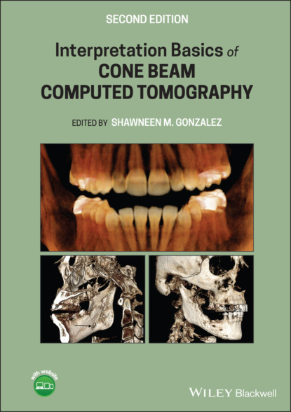 Interpretation Basics of Cone Beam Computed Tomography — Группа авторов