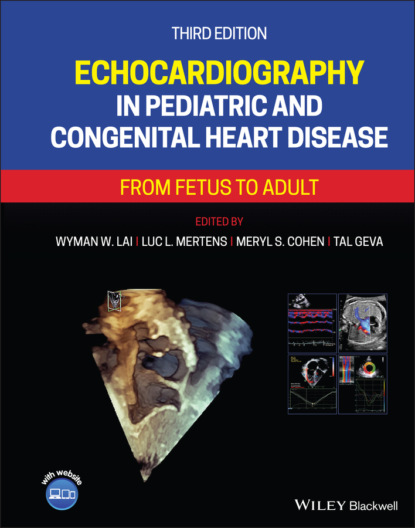 Echocardiography in Pediatric and Congenital Heart Disease — Группа авторов