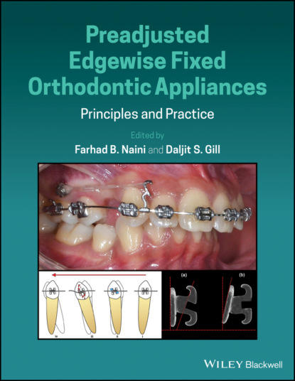 Preadjusted Edgewise Fixed Orthodontic Appliances — Группа авторов