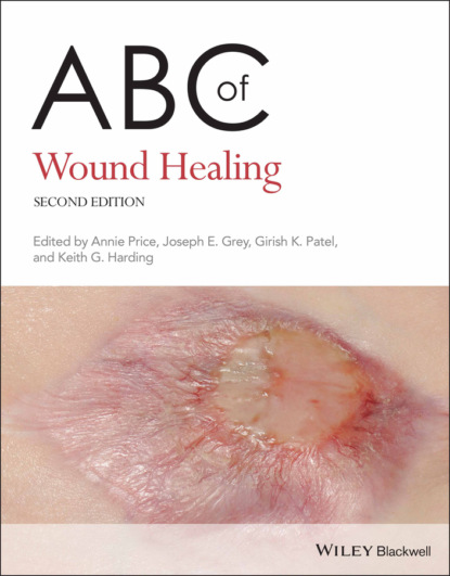 ABC of Wound Healing — Группа авторов