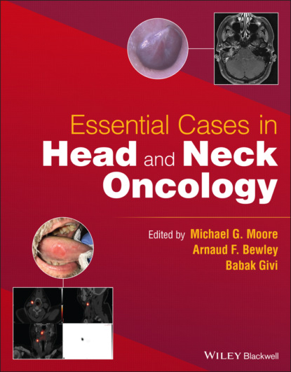 Essential Cases in Head and Neck Oncology — Группа авторов