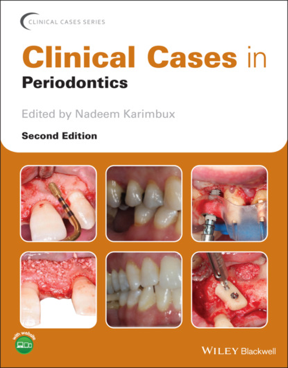 Clinical Cases in Periodontics — Группа авторов