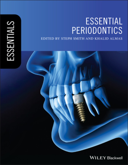 Essential Periodontics — Группа авторов