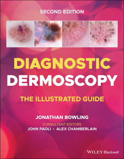 Diagnostic Dermoscopy — Группа авторов