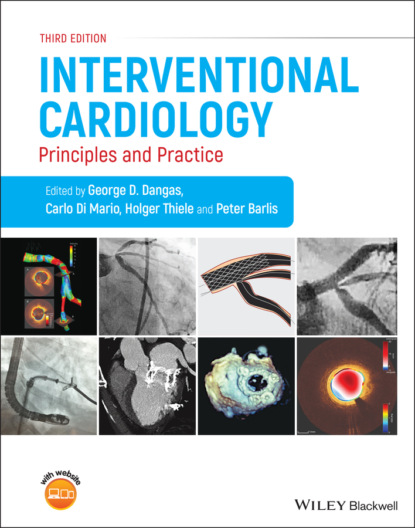 Interventional Cardiology — Группа авторов