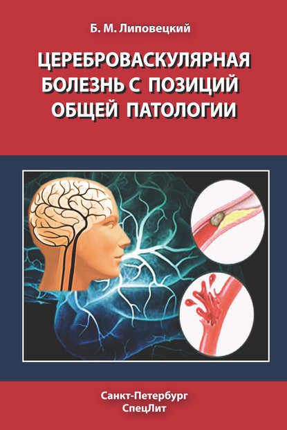 Цереброваскулярная болезнь с позиций общей патологии - Б. М. Липовецкий