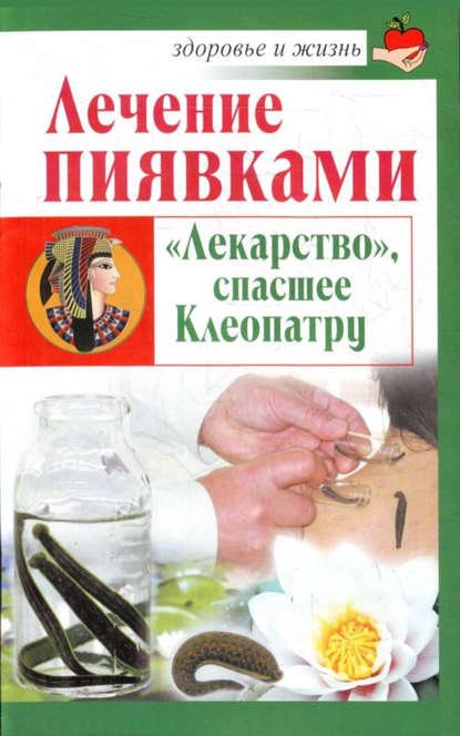 Лечение пиявками. «Лекарство», спасшее Клеопатру — Николай Крамский