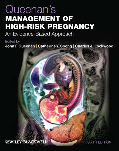Queenan's Management of High-Risk Pregnancy — Группа авторов