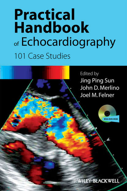 Practical Handbook of Echocardiography — Группа авторов