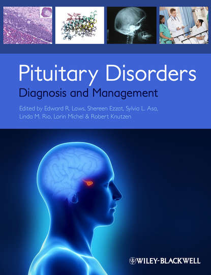 Pituitary Disorders — Группа авторов