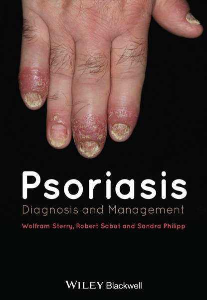 Psoriasis — Группа авторов