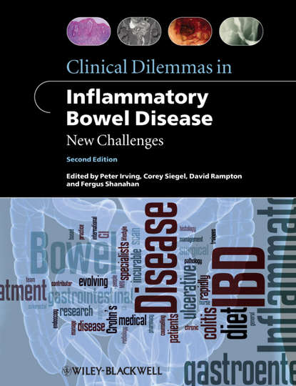 Clinical Dilemmas in Inflammatory Bowel Disease — Группа авторов