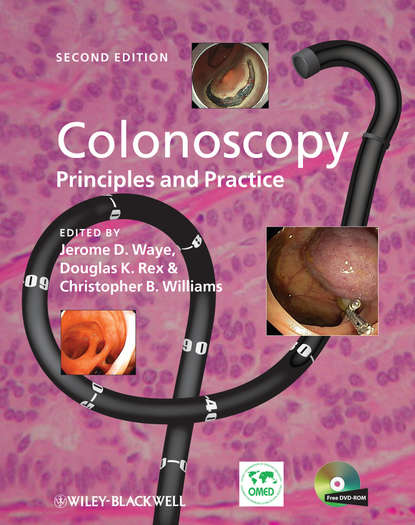 Colonoscopy — Группа авторов
