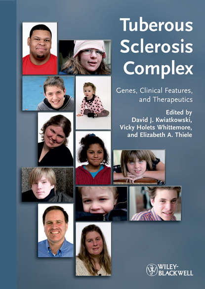 Tuberous Sclerosis Complex — Группа авторов
