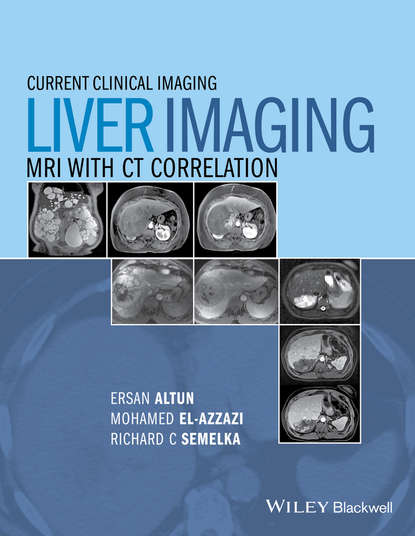 Liver Imaging — Группа авторов