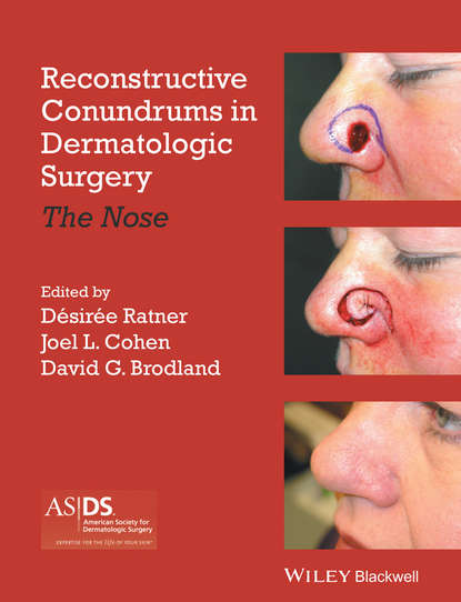 Reconstructive Conundrums in Dermatologic Surgery - Группа авторов