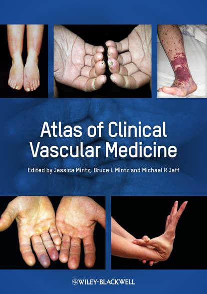 Atlas of Clinical Vascular Medicine — Группа авторов