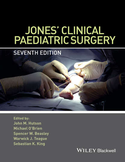 Jones' Clinical Paediatric Surgery — Группа авторов