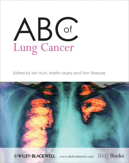 ABC of Lung Cancer — Группа авторов