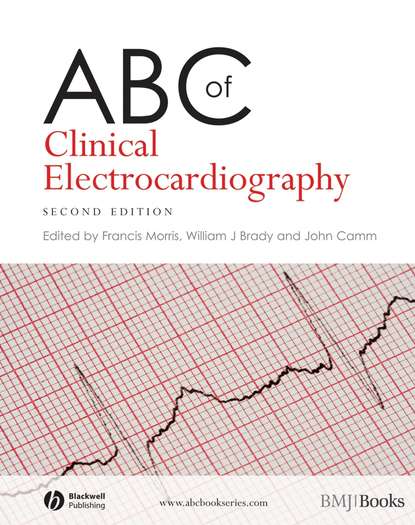 ABC of Clinical Electrocardiography — Группа авторов