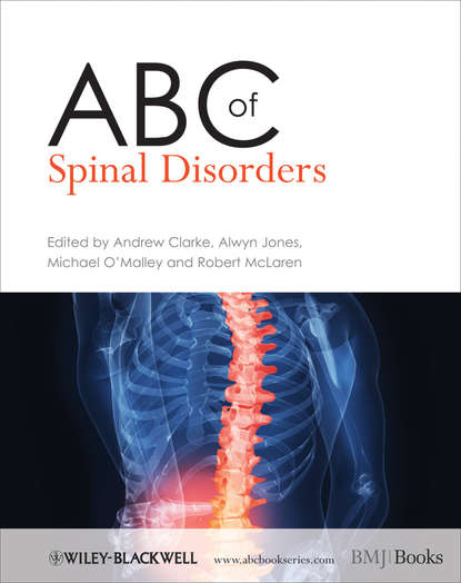 ABC of Spinal Disorders — Группа авторов