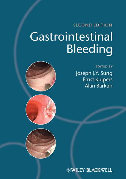 Gastrointestinal Bleeding — Группа авторов