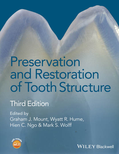 Preservation and Restoration of Tooth Structure — Группа авторов