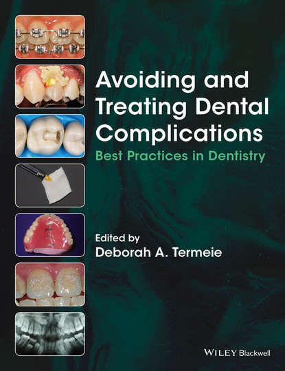Avoiding and Treating Dental Complications — Группа авторов