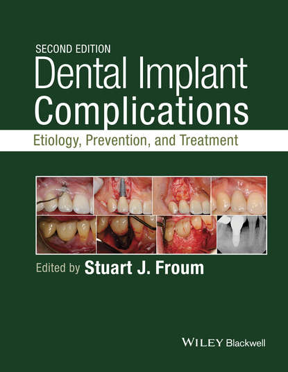 Dental Implant Complications — Группа авторов