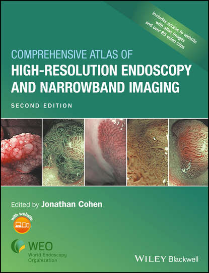 Comprehensive Atlas of High-Resolution Endoscopy and Narrowband Imaging — Группа авторов