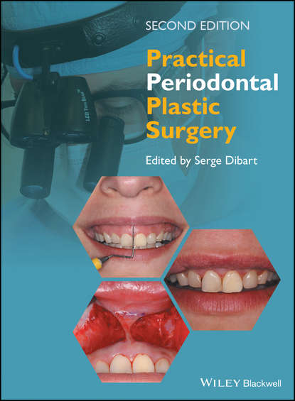 Practical Periodontal Plastic Surgery — Группа авторов