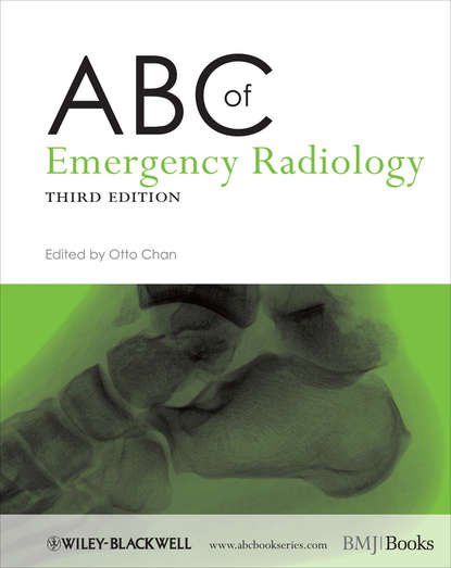 ABC of Emergency Radiology — Группа авторов