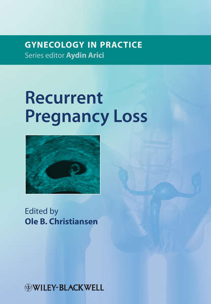 Recurrent Pregnancy Loss — Группа авторов