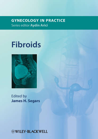 Fibroids — Группа авторов