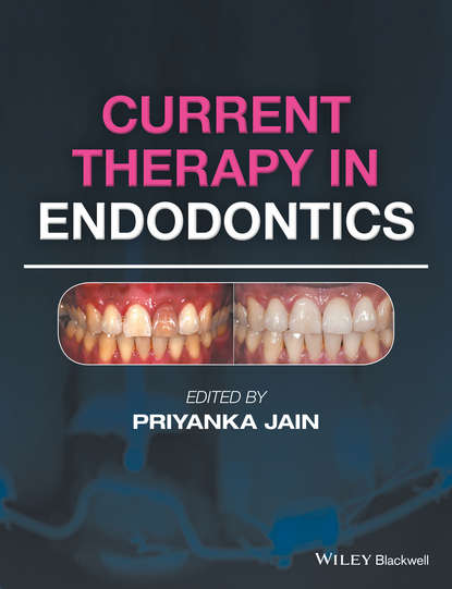 Current Therapy in Endodontics — Группа авторов