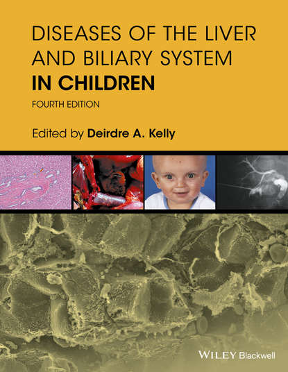 Diseases of the Liver and Biliary System in Children — Группа авторов
