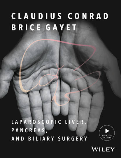 Laparoscopic Liver, Pancreas, and Biliary Surgery — Группа авторов